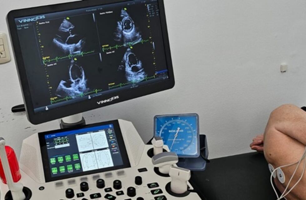 Primer Eco stress Realizado en el Hospital Municipal Anita Eliçagaray