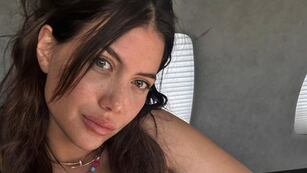 La desgarradora confesión de Wanda Nara sobre su salud: “Tengo que tomar pastillas de por vida”
