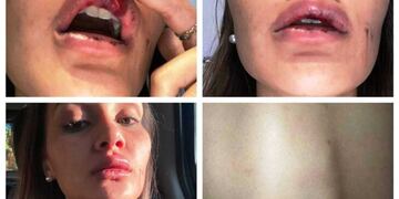 El agresor le dio entre 15y 20 piñas en el rostro