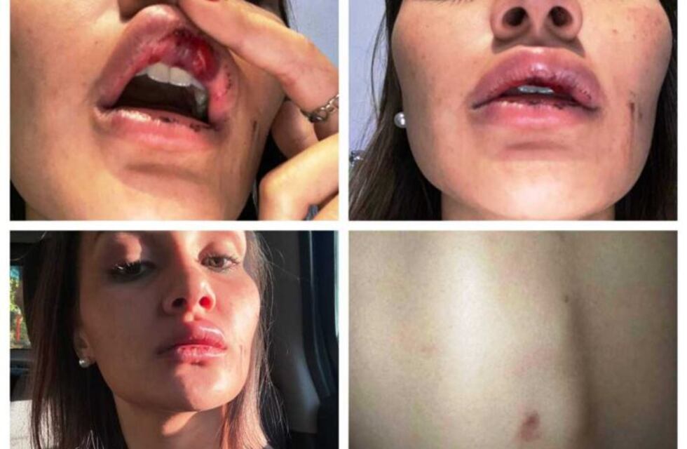 Modelo eldoradense fue brutalmente golpeada por su expareja