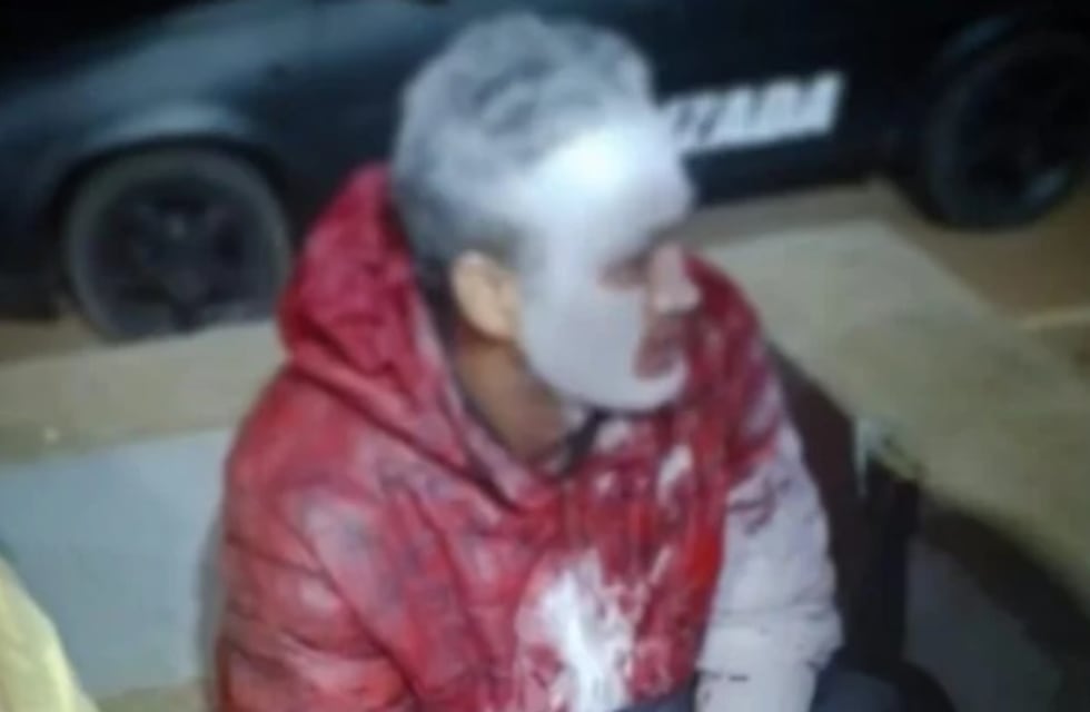 Insólito: se pintó la cara para no ser reconocido y terminó detenido por robo