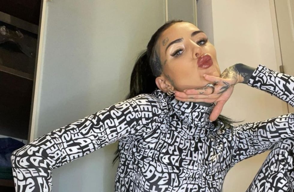 Nariz, labios y más: Cande Tinelli reveló la cantidad de cirugías estéticas que se hizo