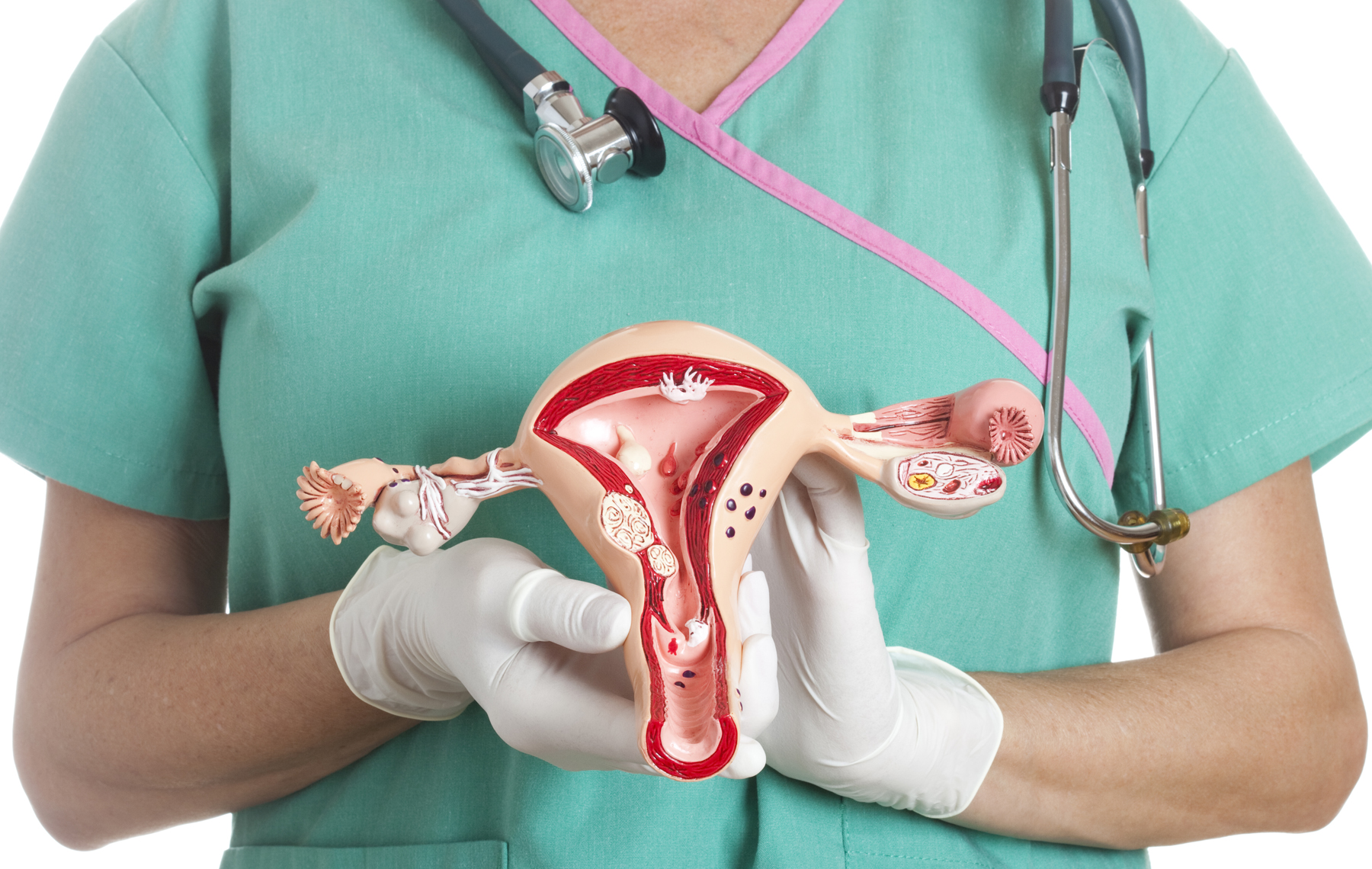 Campaña gratuita de PAP: una acción clave para prevenir el cáncer de cuello uterino