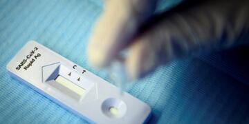 autotest test rápido  test de autoevaluación del Covid-19
ID:4888797 A health worker performs a 'SARS-CoV-2 Rapid Antigen' test just after collecting a nose swab sample for a polymerase chain reaction (PCR) at the coronavirus testing facility of Unisante, the university center for general medicine and public health, in Lausanne, Switzerland, Monday, Nov. 9, 2020. (Laurent Gillieron/Keystone via AP)