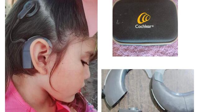 Robaron un estuche que contenía las baterías del implante que usa una nena de 5 años para poder escuchar.