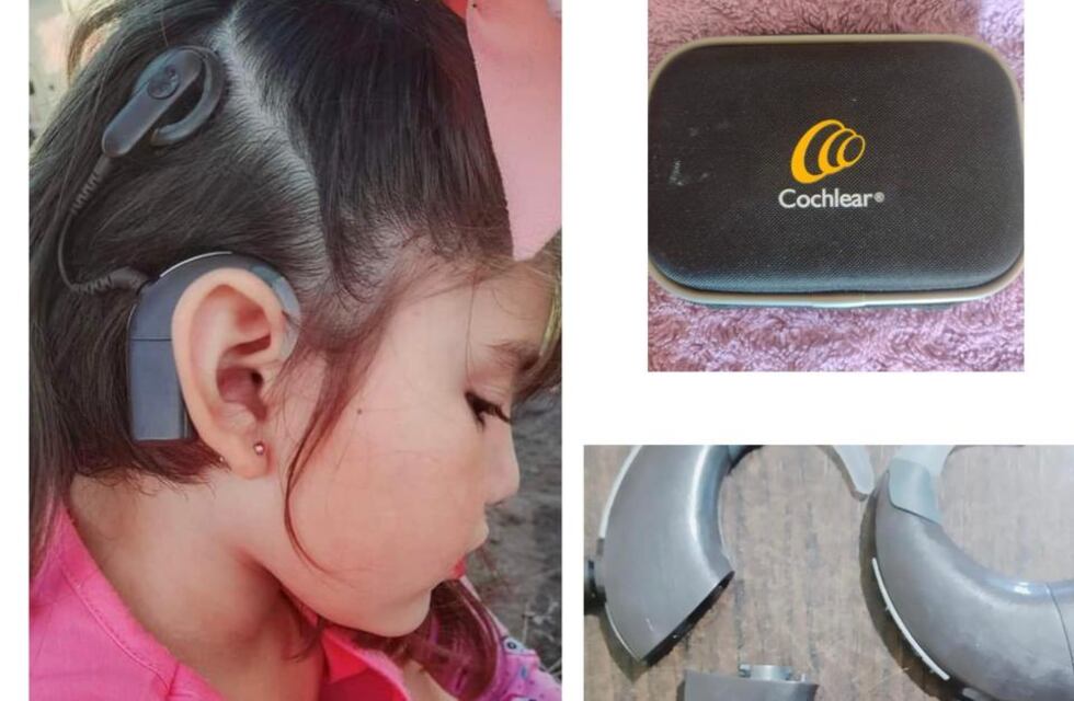 Robaron la batería del implante que usa una nena de 5 años para poder escuchar y su familia pide ayuda