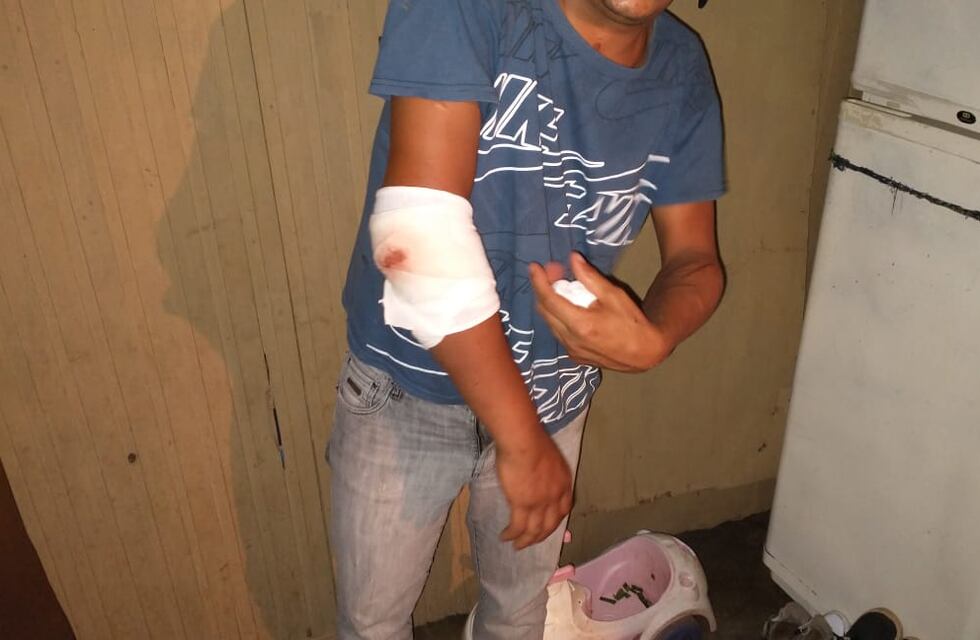 IMAGENES SENSIBLES/ Un hombre de la chacra 181 de Posadas denuncia que su vecino lo quiere matar