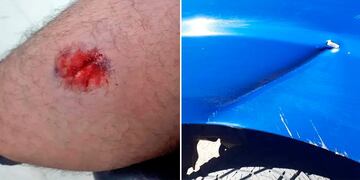 El policía fue mordido en uno de sus brazos, por un hombre que luego dio hachazos a su patrullero.