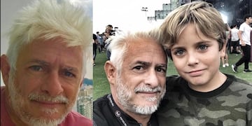 Su hijo tuvo un accidente grave.