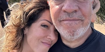 Preocupación por el hijastro de Coco Sily tras ser atropellado: “Tiene parte de su cuerpo inmovilizado”.