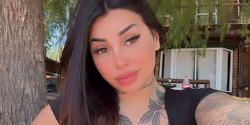 Tamara Báez se hizo una nueva cirugía estética y mostró el impactante cambio: “Me puse...”