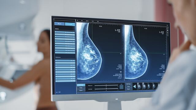 El aparato ayuda a las mujeres a transitar el cáncer de mama.