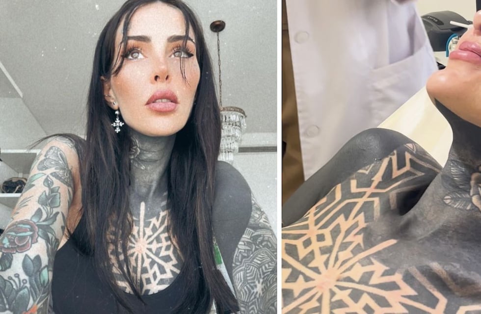 Cande Tinelli se borró un tatuaje: cómo es y qué tanto duele el procedimiento