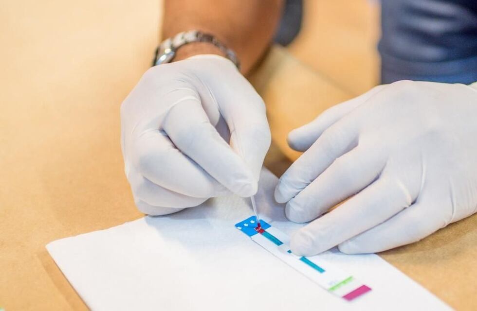 La municipalidad realizó testeos gratuitos de VIH con amplia concurrencia